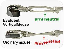 Evoluent Mouse Evoluent VerticalMouse 4 Right Mac