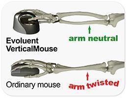 Evoluent Mouse Evoluent VerticalMouse 4 Right Mac