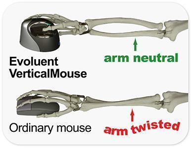 Evoluent Mouse Evoluent VerticalMouse C Right Wired